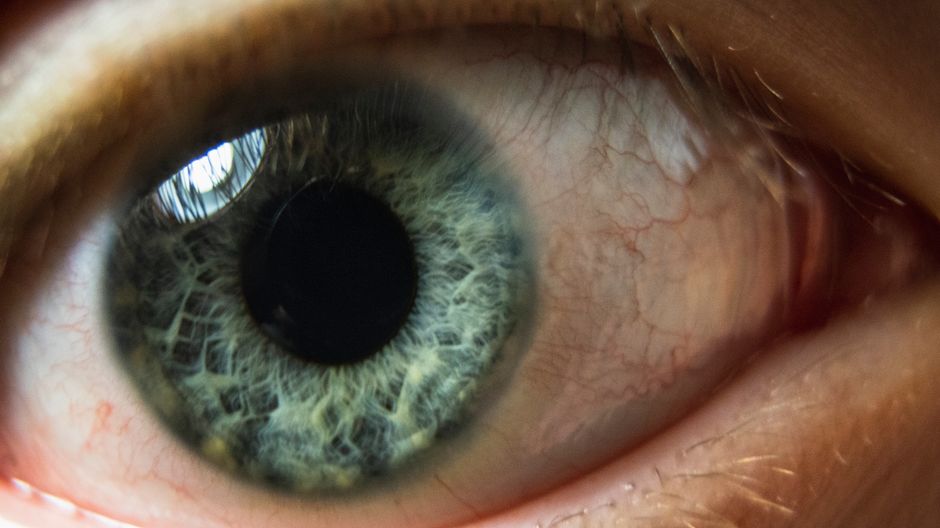 pexels-photo-3695874-large.jpeg 辣椒喷雾喷到眼睛会失明吗?多久能恢复正常?(图2)